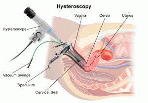 Diagnostic and Operative Hysteroscopy at Al Manar Fertility Clinic Basrah